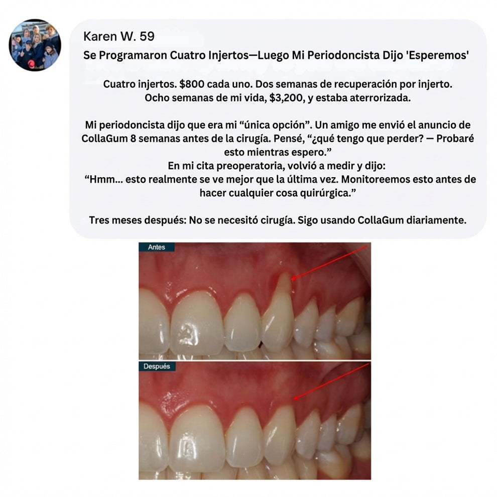 CollaGum™ - Firmer Gums Without Surgery