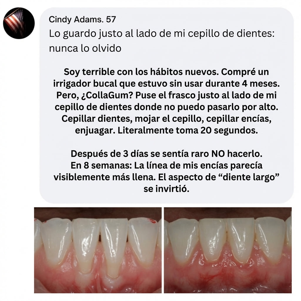 CollaGum™ - Firmer Gums Without Surgery