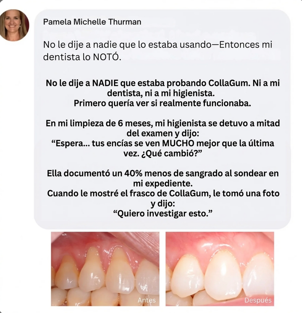 CollaGum™ - Firmer Gums Without Surgery