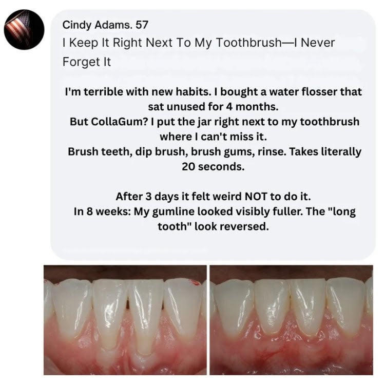 CollaGum™ — Firmer Gums Without Surgery