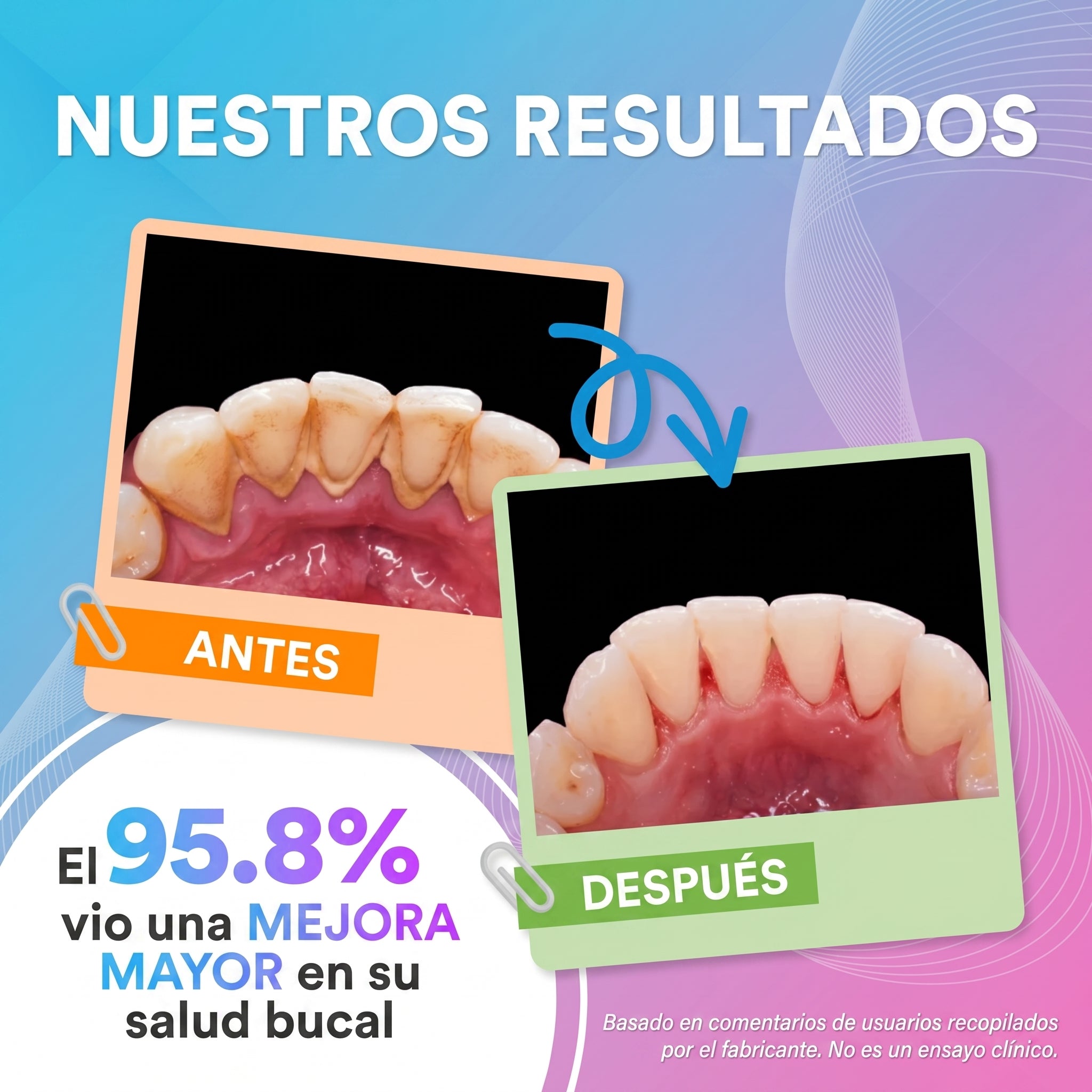 Irrigador Bucal Pro (5 en 1)