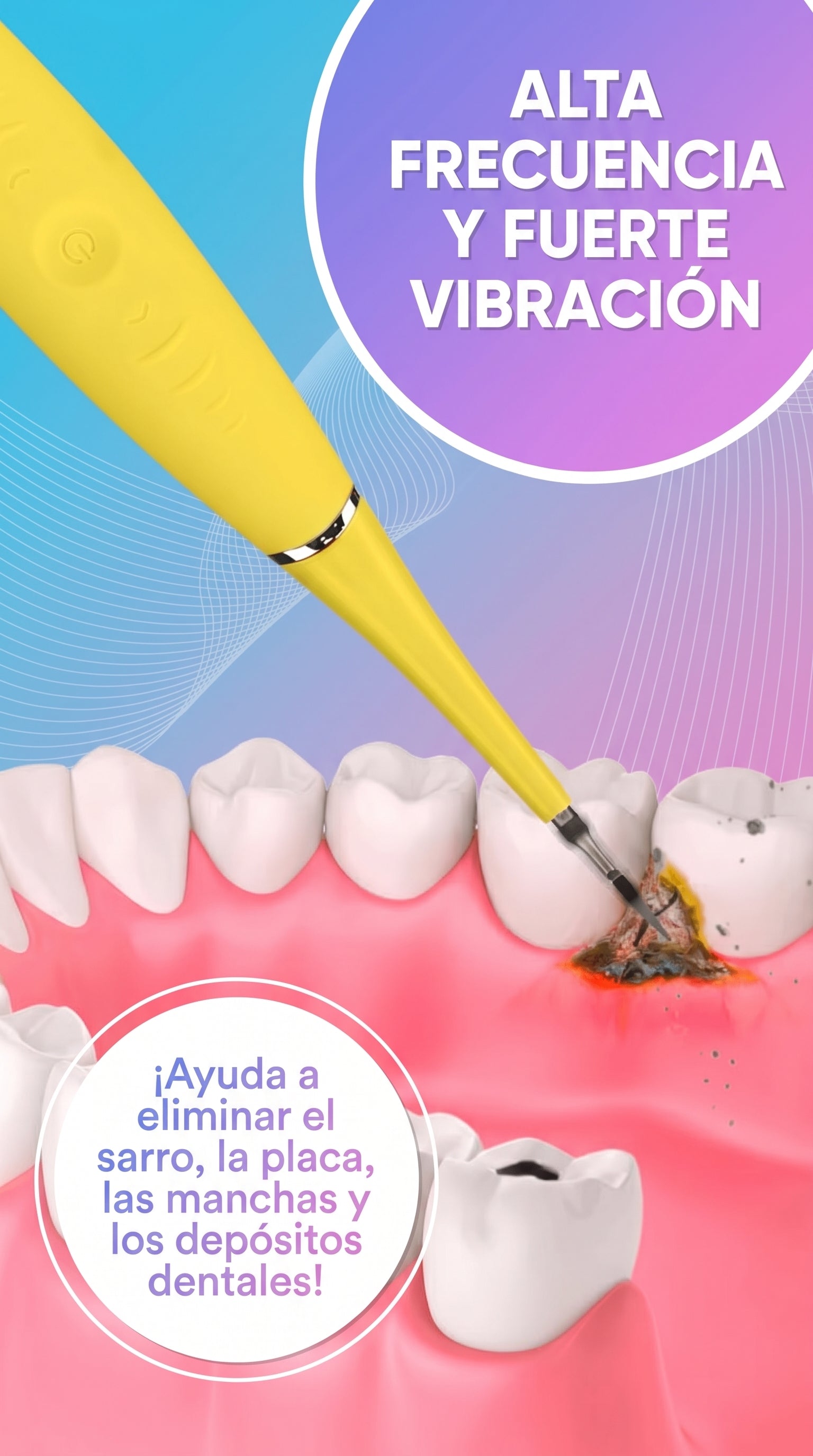 Limpiador Dental Ultrasónico