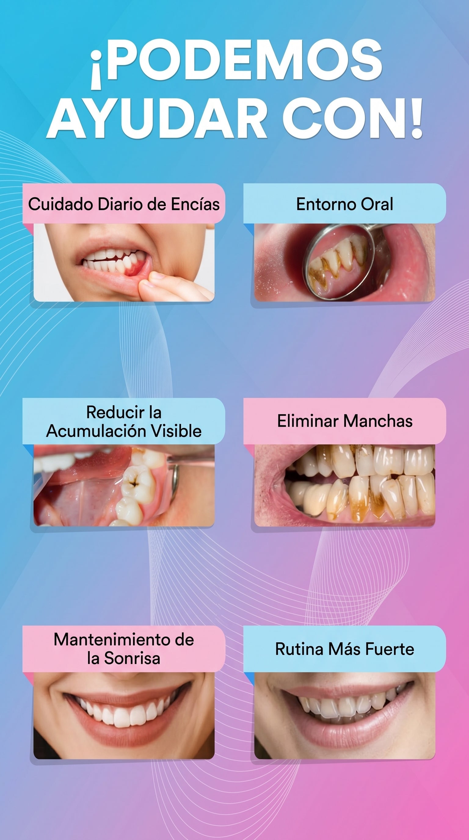 Limpiador Dental Ultrasónico